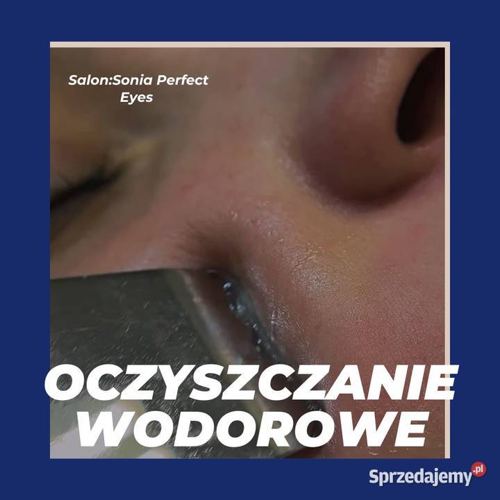 Oczyszczanie wodorowe Pozostałe