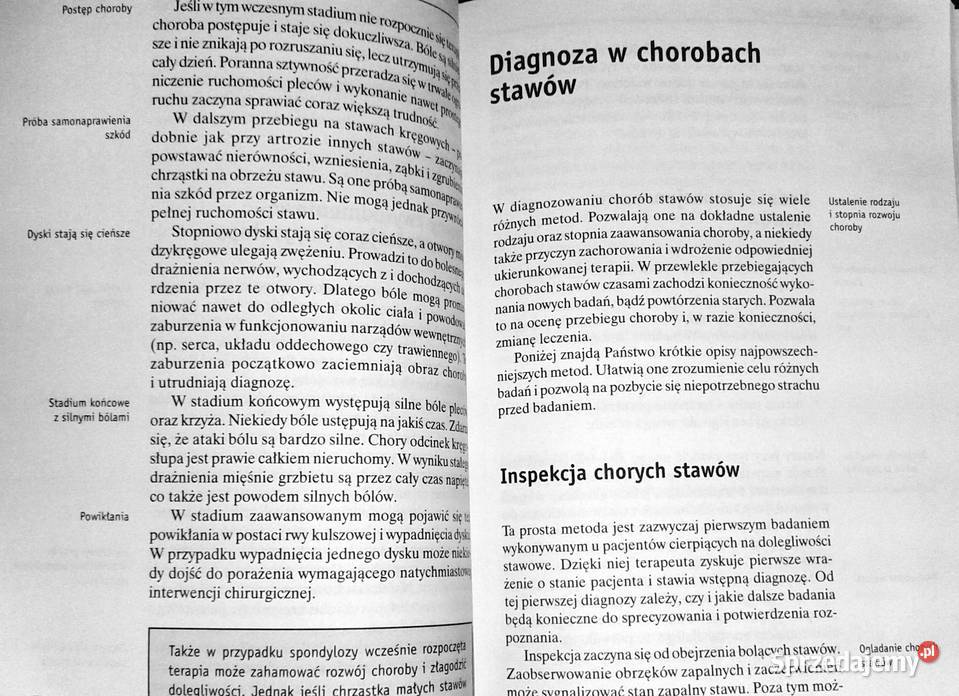 Choroby stawów Gerhard Leibold Pozostałe lubelskie Chełm