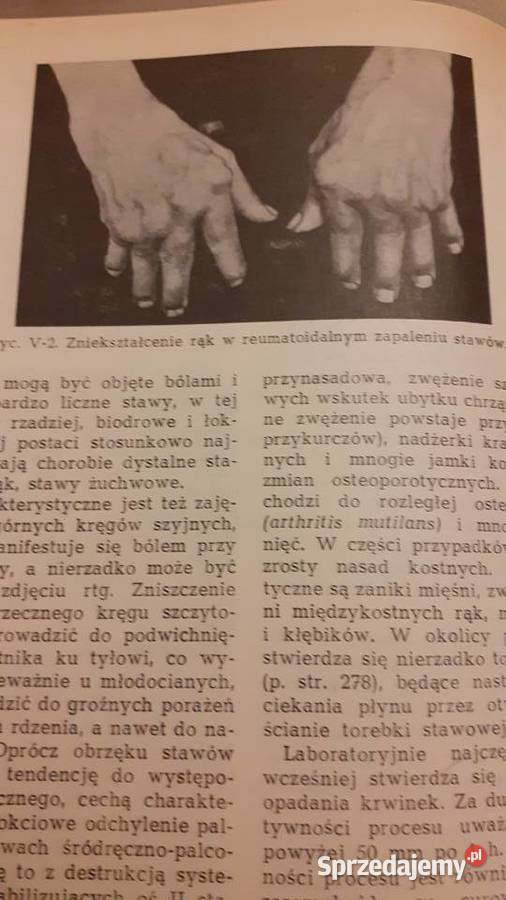 Choroby wewnetrzne Szczecin