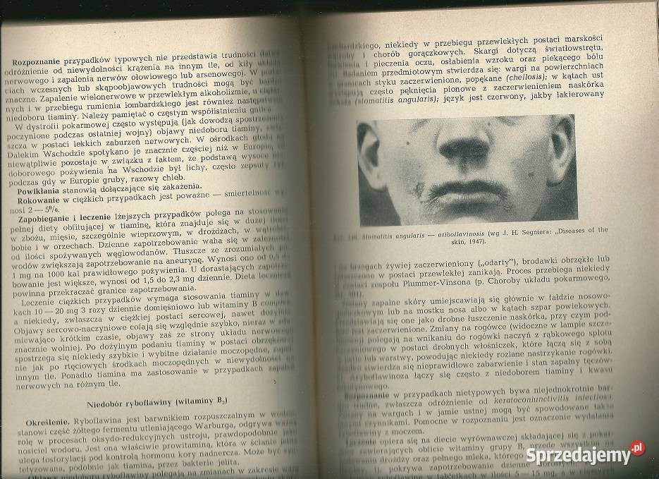 Choroby wewnętrzne Edward Szczeklik 1968 medycyna, nauki medyczne łódzkie Łódź