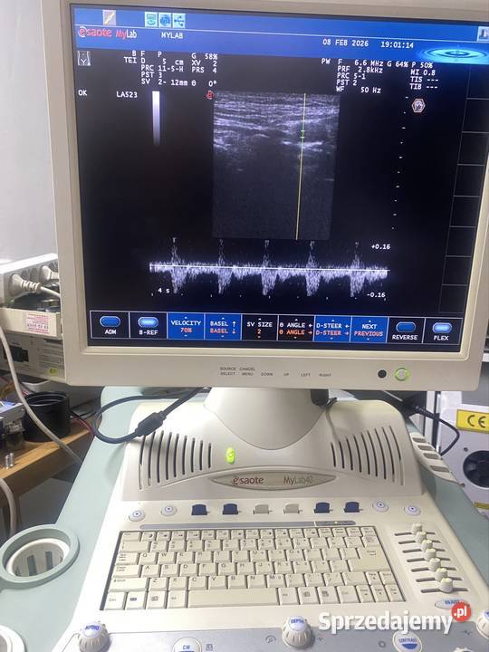 Aparat usg z doplerem kolorowym Wyposażenie szpitali i gabinetów Nysa