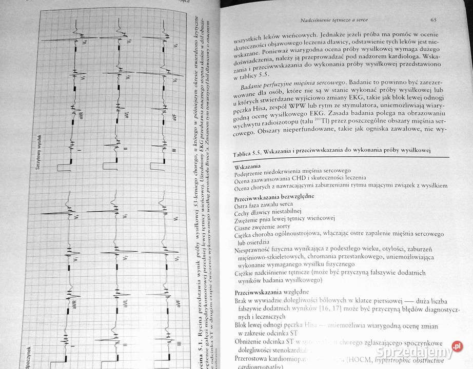 Nadciśnienie tętnicze i choroby współistniejące Chełm