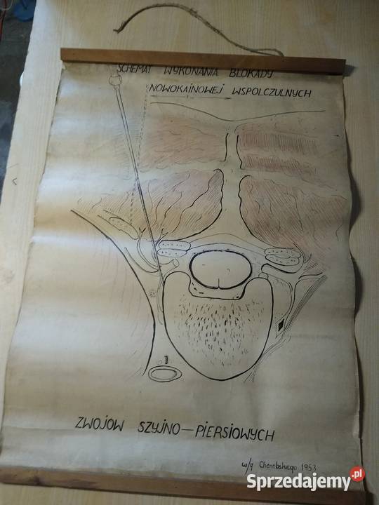 plakat schemat wykonania blokady nowokainowej mazowieckie Warszawa