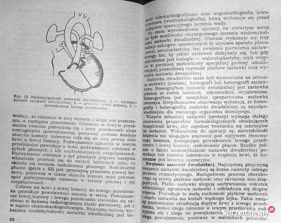 O chorobach serca u dzieci Krystyna Kubicka D lubelskie