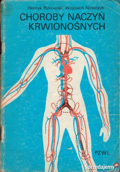 Choroby naczyń krwionośnych Rok wydania 1985 Oświęcim