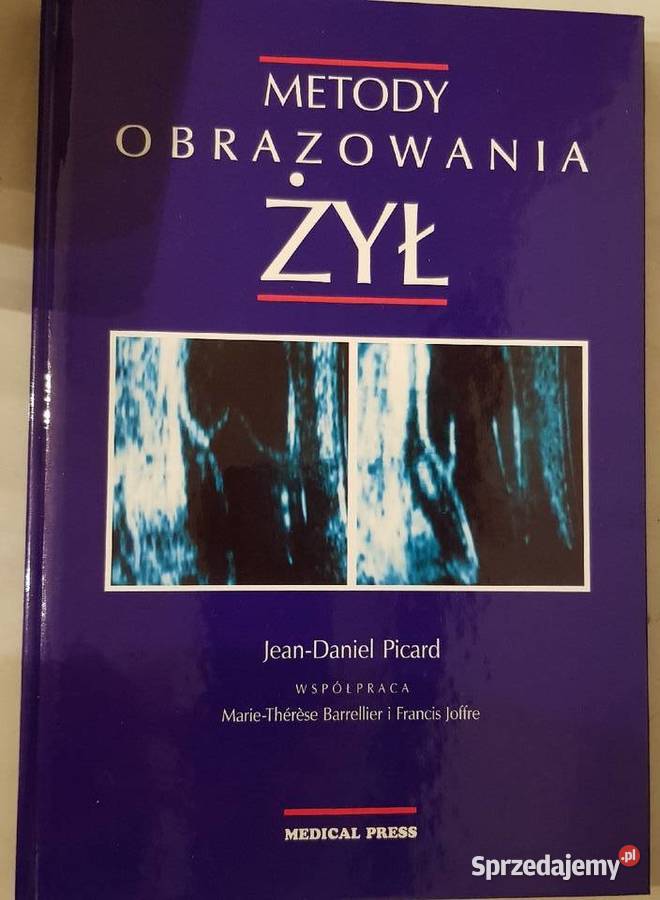metody obrazowania żył medycyna diagnostyka Kielce