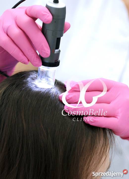 Trychologia CosmoBelle Clinic Tychy