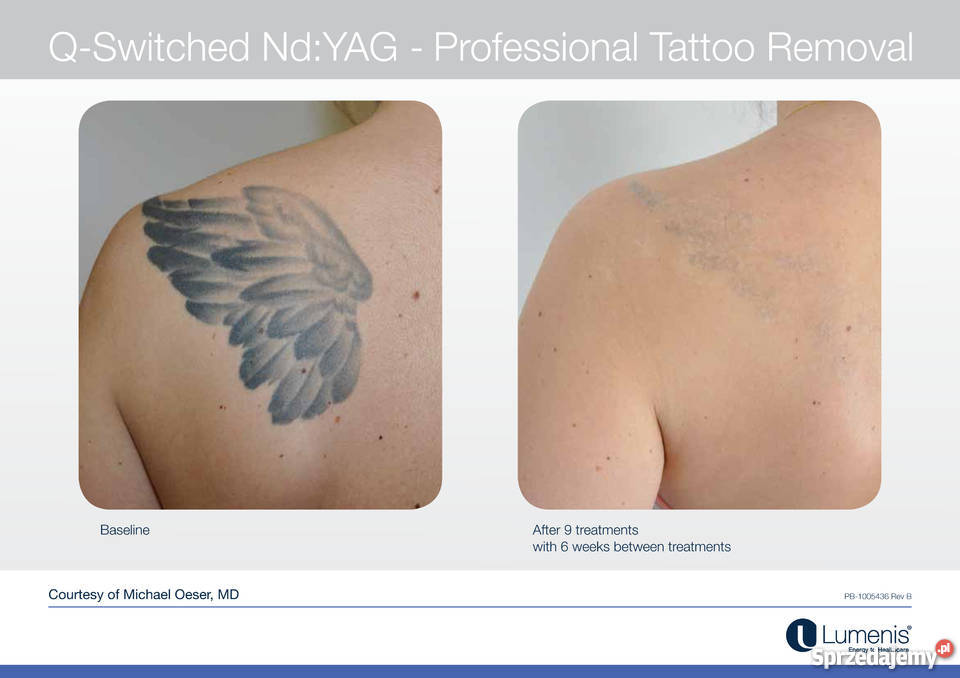 M22 Luenis Coherent Polska Pozostałe małopolskie sprzedam