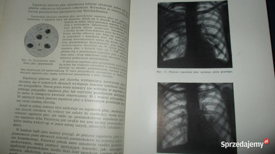 Choroby wewnętrznered H Dennig Berger medycyna łódzkie sprzedam
