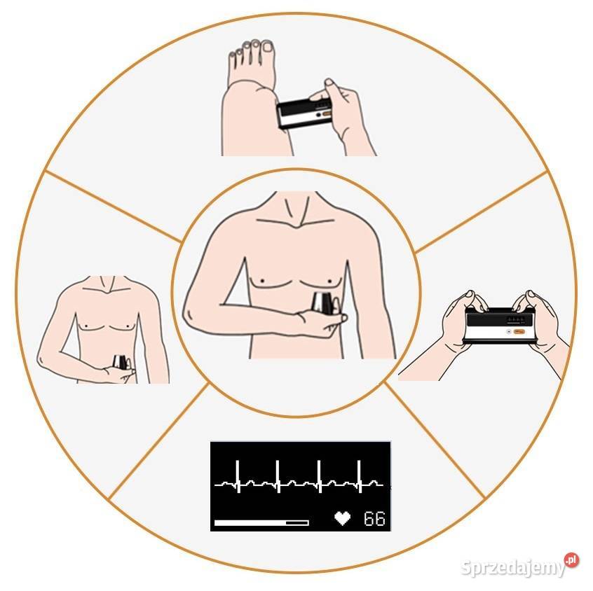 Aparat Monitor EKG Ciśnieniomierz BP2 IOS śląskie Myszków