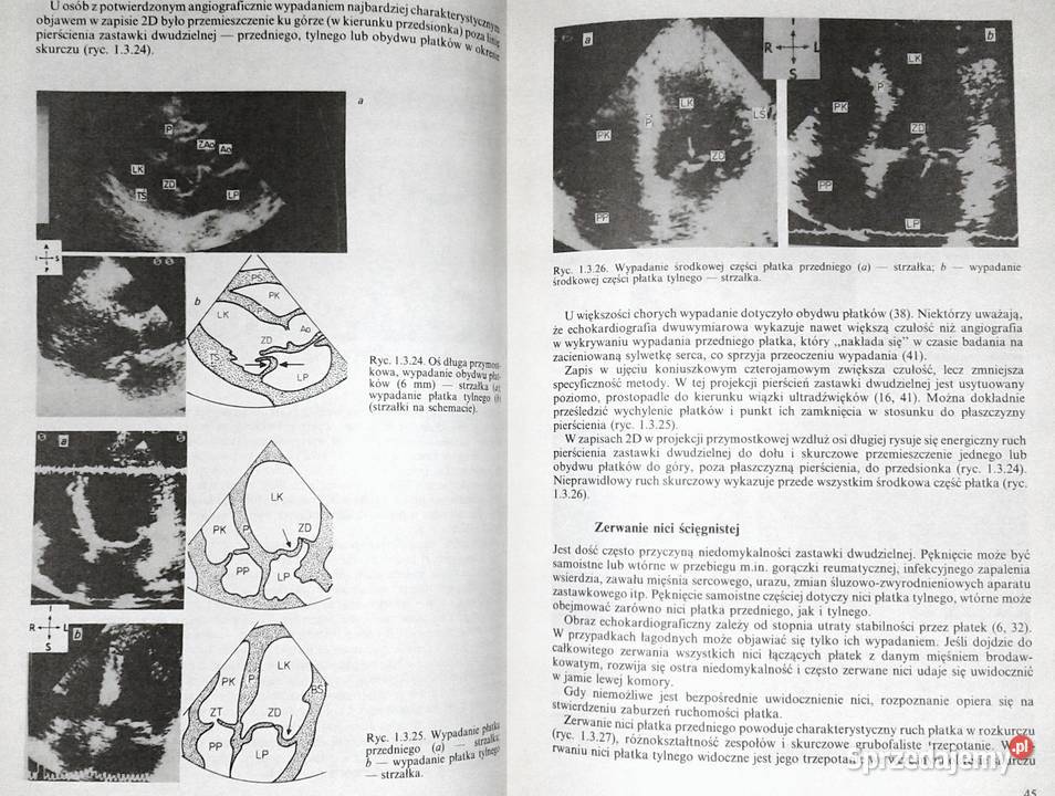 Metody obrazowe w diagnostyce chorób układu Chełm
