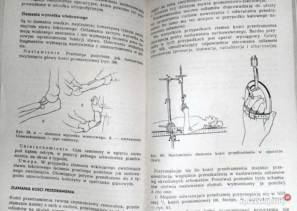 Zasady leczenia złamań i urazów kończyn Bogdan Chełm