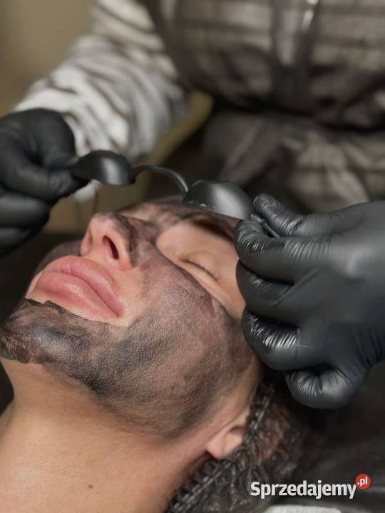 Peeling węglowy efekt Black Doll w Twoim zasięgu Katowice