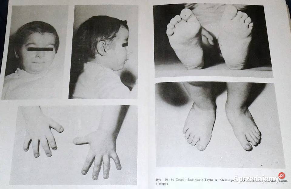 Choroby układu nerwowego dzieci i młodziezy J Chełm sprzedam