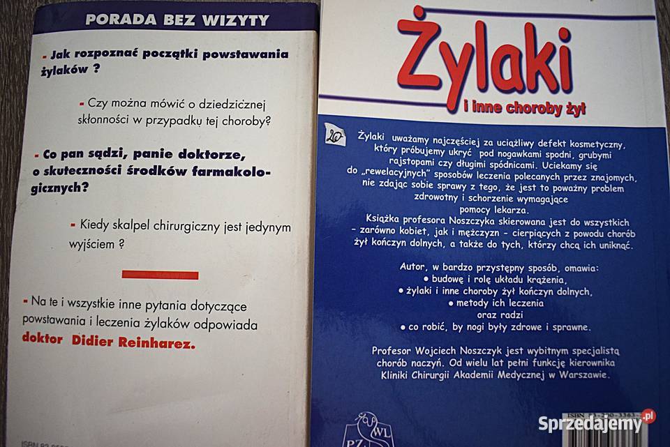 Żylaki leczenie profilaktyka przyczyny objawy kujawsko-pomorskie Chełmno