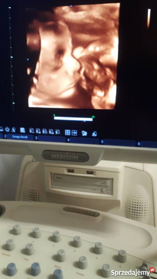 APARAT USG MEDISON X8 4 sondy Gdańsk sprzedam