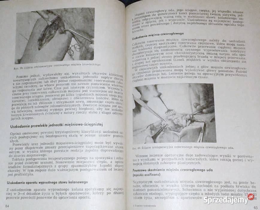 Urazowe uszkodzenia kolana Wojciech Maria Kuś Rok wydania 1984 Chełm