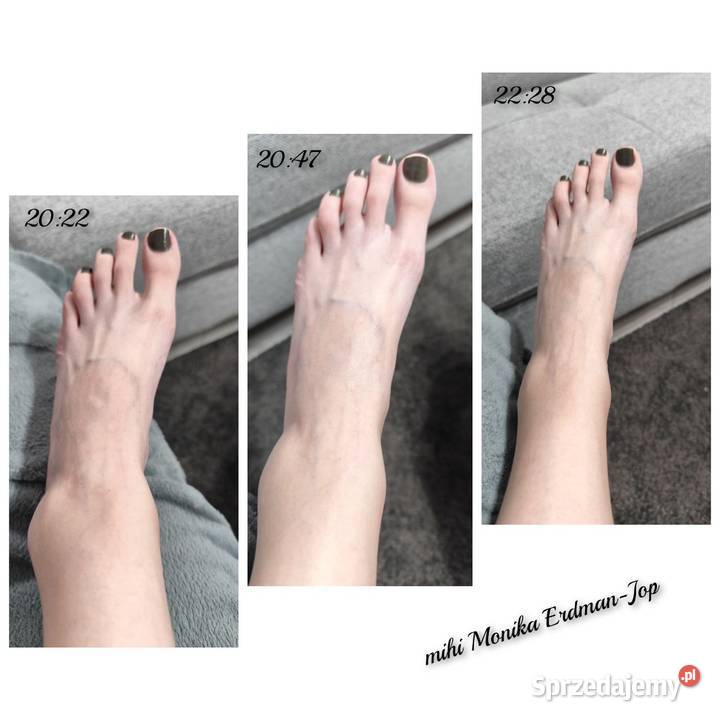 Venotonic żel chłodzący na zmęczone nogi żylaki Kosmetyki