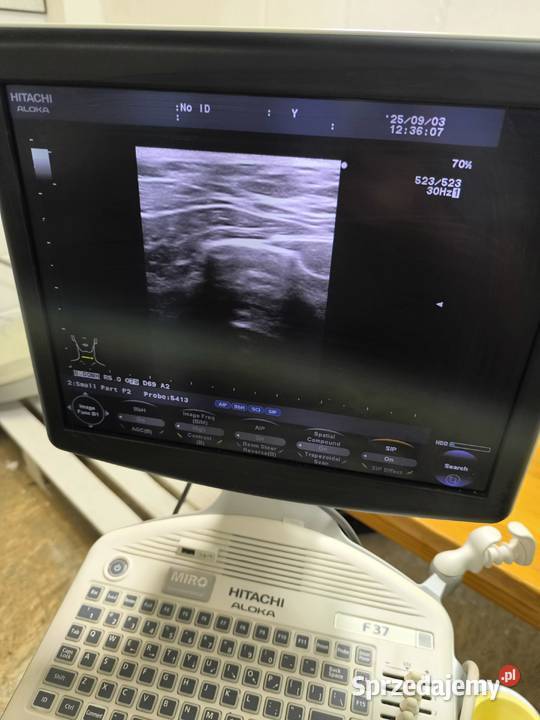 USG Hitachi Aloka F37 Urządzenia mazowieckie Jabłonna