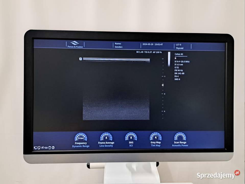 Aparat ultrasonograficzny FocusFusion Healthcare Słomczyn