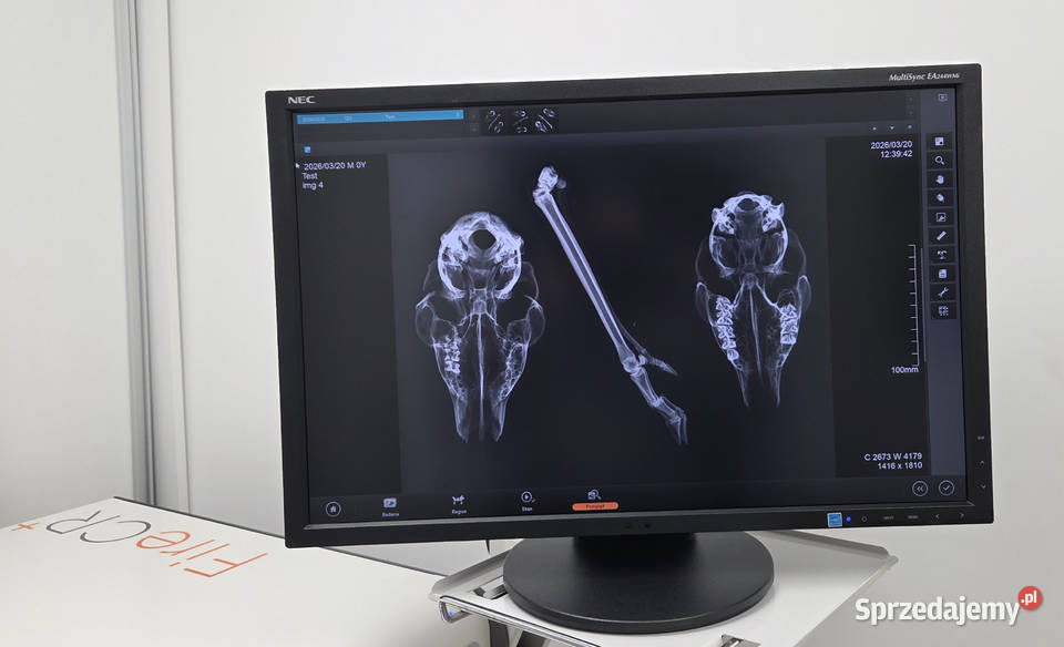 Rentgen przenośny ATOMSCOPE 100 Gierth skaner dolnośląskie Wrocław