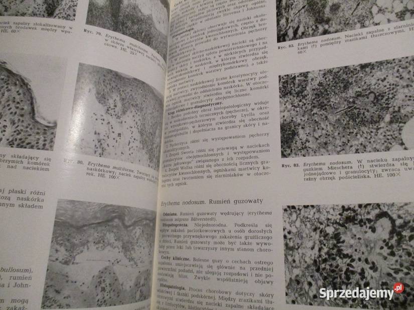 Atlas histopatologii skóry Woźniak Giryn skóra łódzkie Łódź