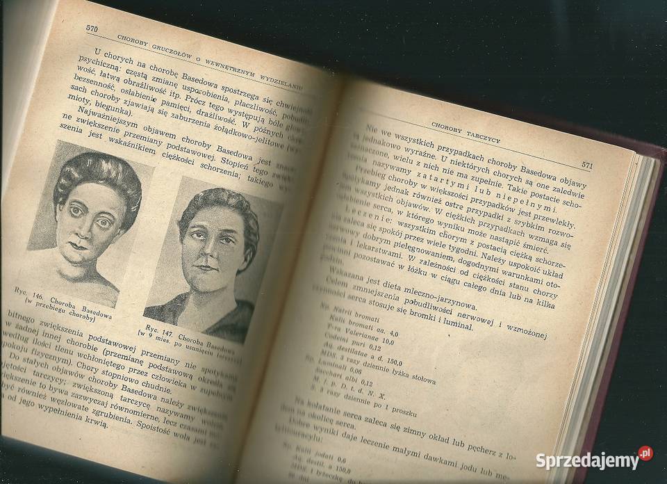 Choroby wewnętrzne podręcznik średnich szkół Łódź sprzedam
