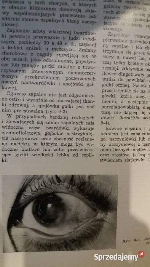 Okulistyka współczesna outlet studia medycyna Antyki, Sztuka, Kolekcje
