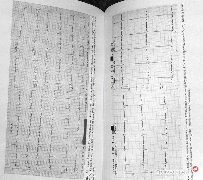 Kardiologia lekarzy rodzinnych Cezary Ścibiorski Chełm