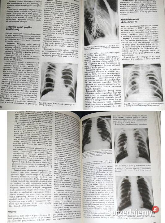 Nauka o chorobach wewnętrznych Tom 5 Witold Chełm