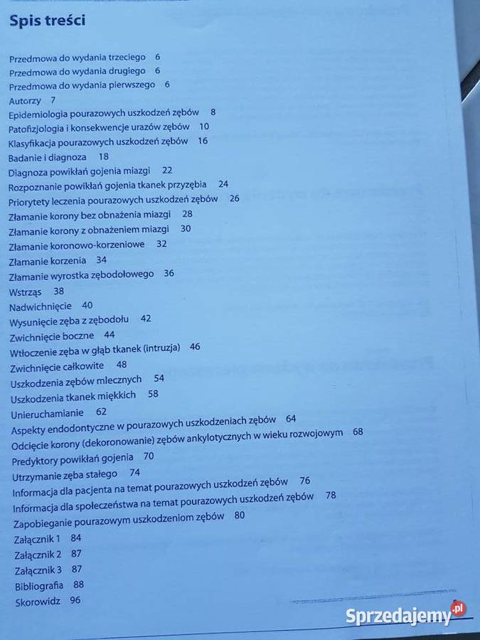 Pourazowe uszkodzenia zębów stomatologia Kielce