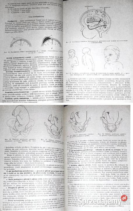 Położnictwo ćwiczenia Michał Troszyński Chełm