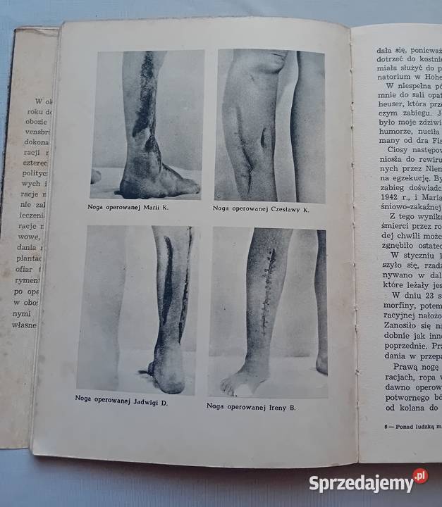 Ponad ludzką miarę Wspomnienia operowanych z Rav Koźminek