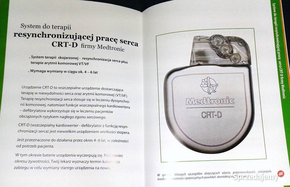 Zrozumienie terapii resynchronizacji serca w Chełm sprzedam