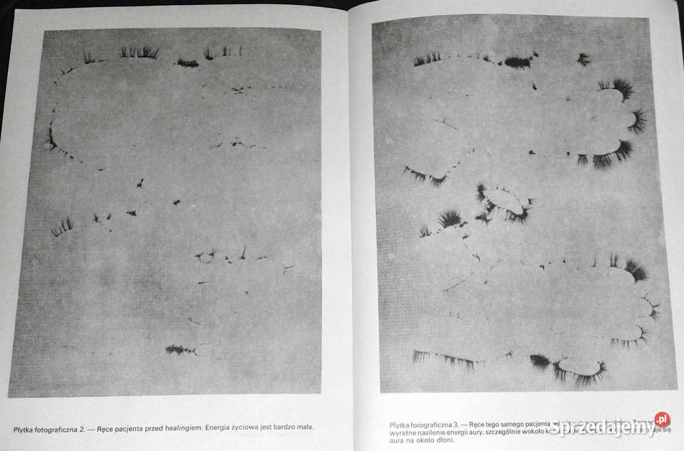 Healing czyli uzdrawianie Lorna St Aubyn