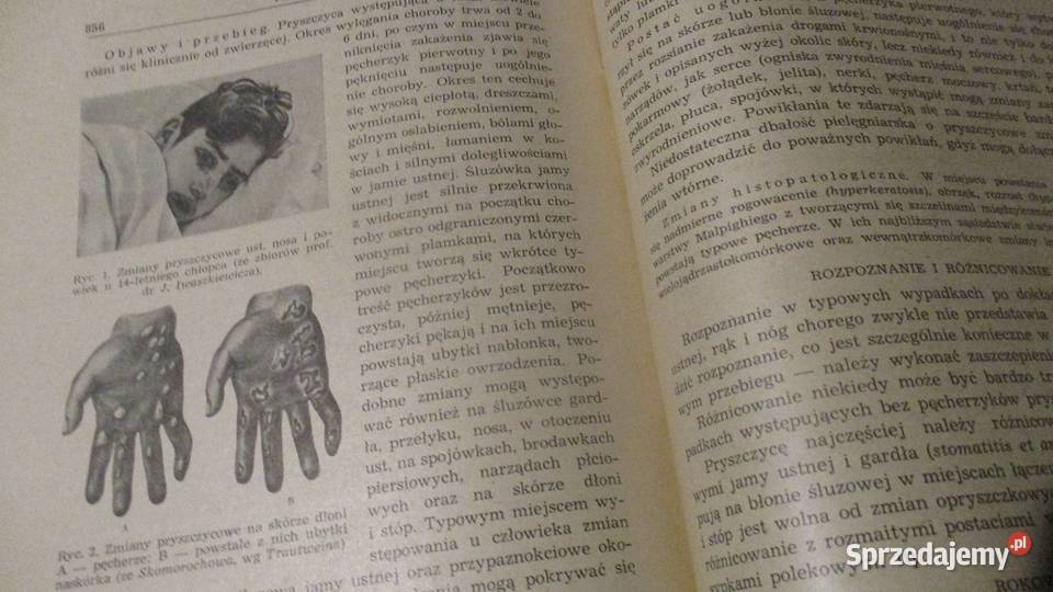 Ostre choroby zakaźnepodręcznik lekarzy medycyna, nauki medyczne Łódź