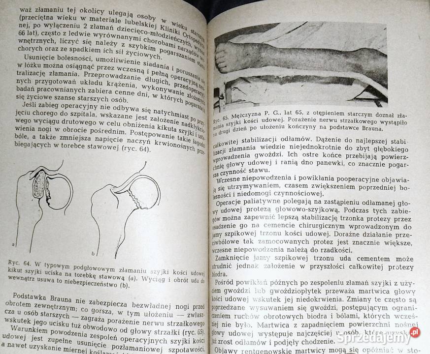 Niepowodzenia w leczeniu uszkodzeń narządów sprzedam