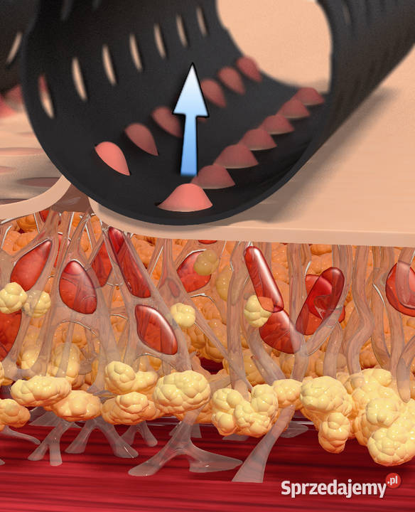 ICOONE LASER 2018 super stan Łódź sprzedam