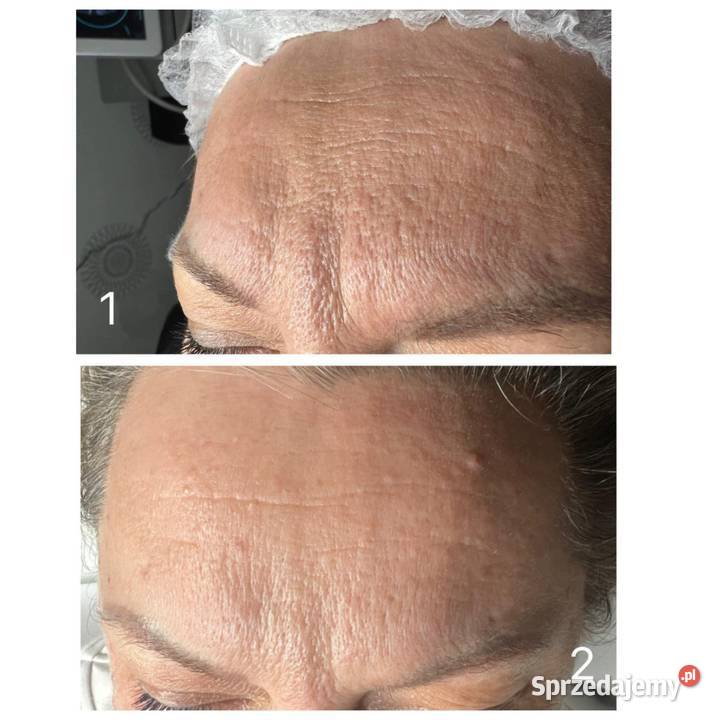 RF FRAKCYJNY zachodniopomorskie Szczecin sprzedam