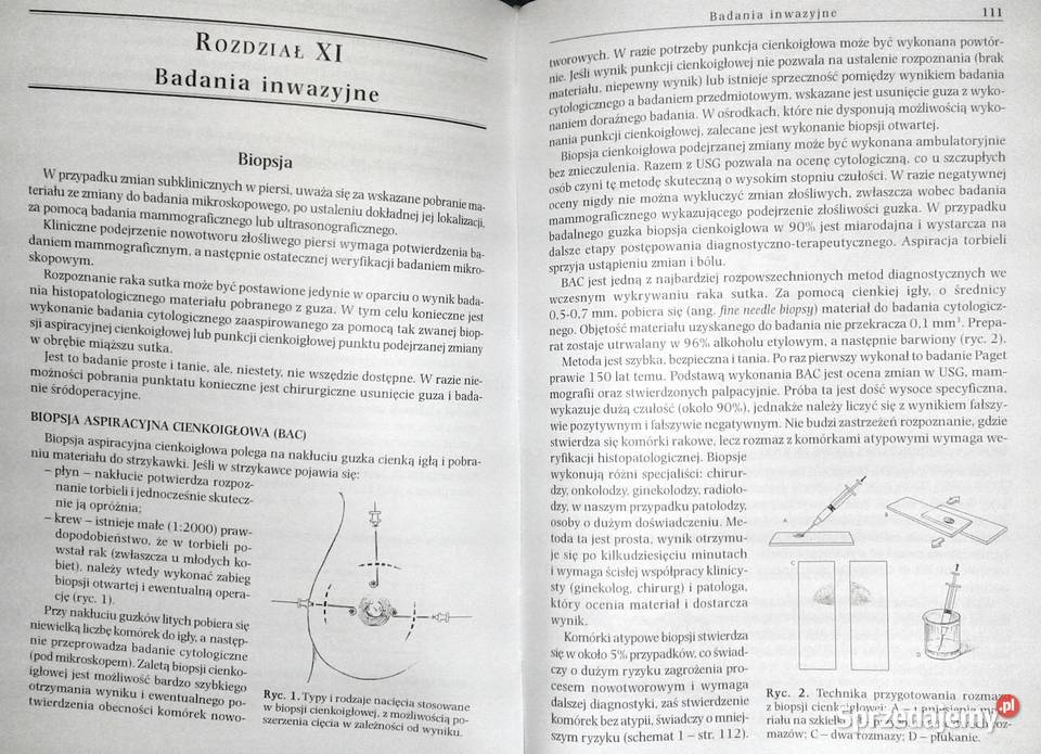 Choroby gruczołu sutkowego menopauza Roman Chełm