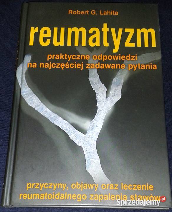 Reumatyzm Robert G Lahita Chełm