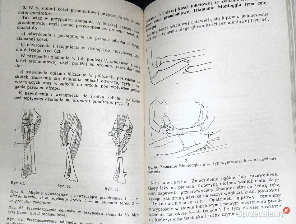 Zasady leczenia złamań i urazów kończyn Bogdan Chełm sprzedam