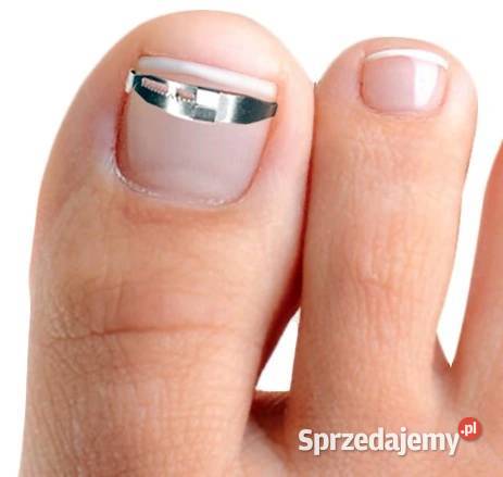 Specjalne klamry na wrastające paznokcie 2 Unisex Płock