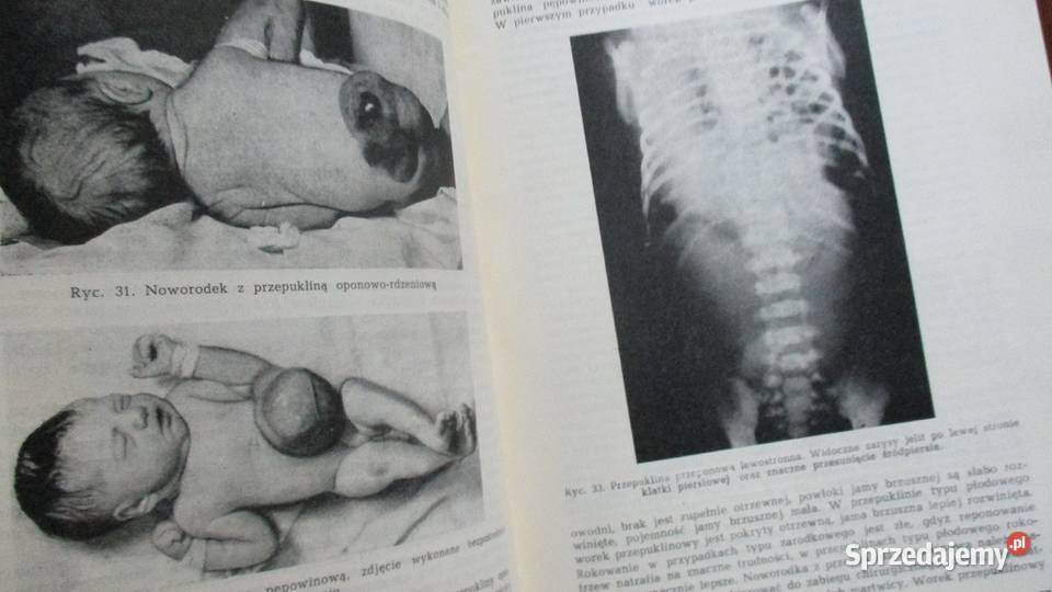 Fizjopatologia noworodka i wcześniaka Łódź