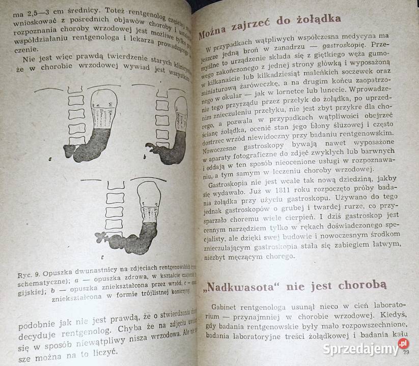 Wrzód żołądka i dwunastnicy Jan Hipolit Bayer lubelskie Chełm