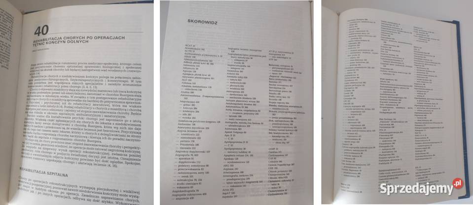 książka medyczna Choroby naczyń Henryk Rykowski Kielce