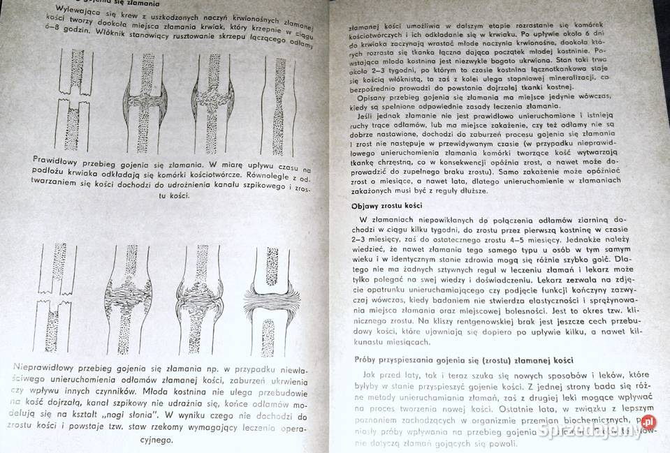 Złamania kości i zwichnięcia stawów J Babecki A Chełm