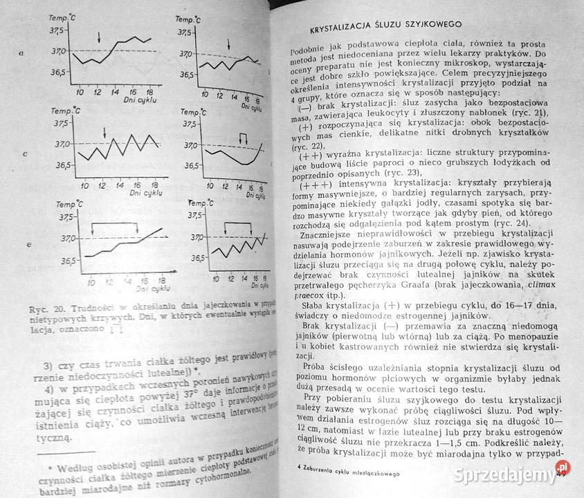 Zaburzenia cyklu miesiączkowego Janusz Okła