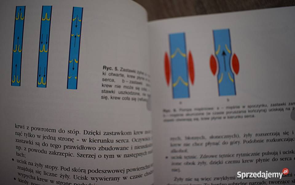 Żylaki leczenie profilaktyka przyczyny objawy