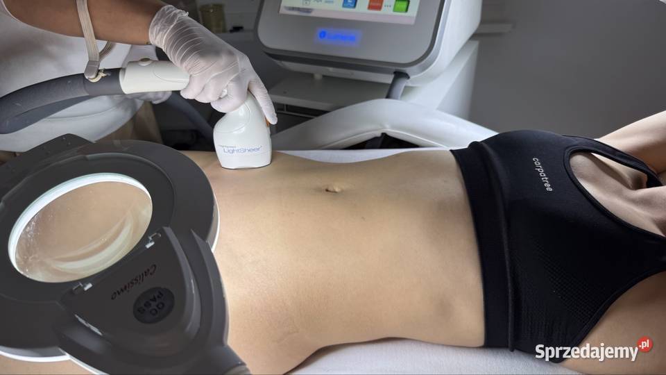 Depilacja laserowa Mosty Kosakowo pomorskie